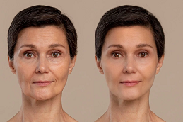 ozempic injection price in saudi arabia