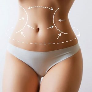 360 Liposuction Cost in Riyadh