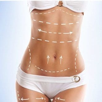 360 Liposuction Cost in Riyadh