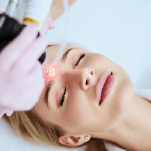Skin Laser Treatments In Dammam