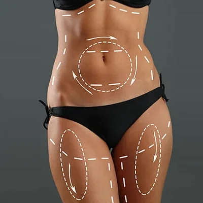 Liposuction In Riyadh by Dr. Rabih | Royal Clinic
