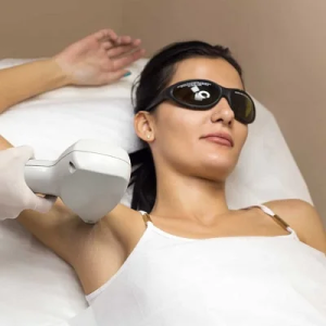 A Comprehensive Laser Hair Removal Guide