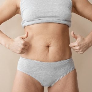 6 Ways to Reduce Tummy Tuck Scarring