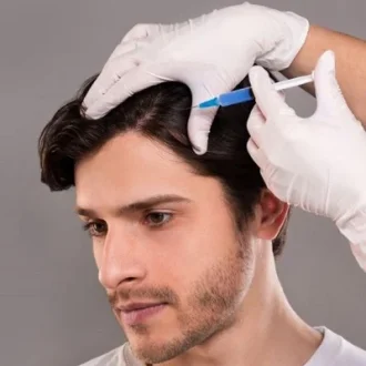 PRP Injections for Hair Loss: What You Need to Know