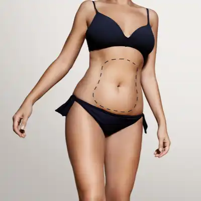 Body Lift Surgery: Everything You Need to Know