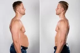 Best Fat Melting Injections in Riyadh