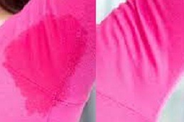 Botox underarm sweating before and after