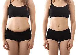 before and after mounjaro injection results