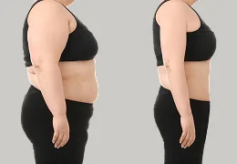 mounjaro treatment before after transformation